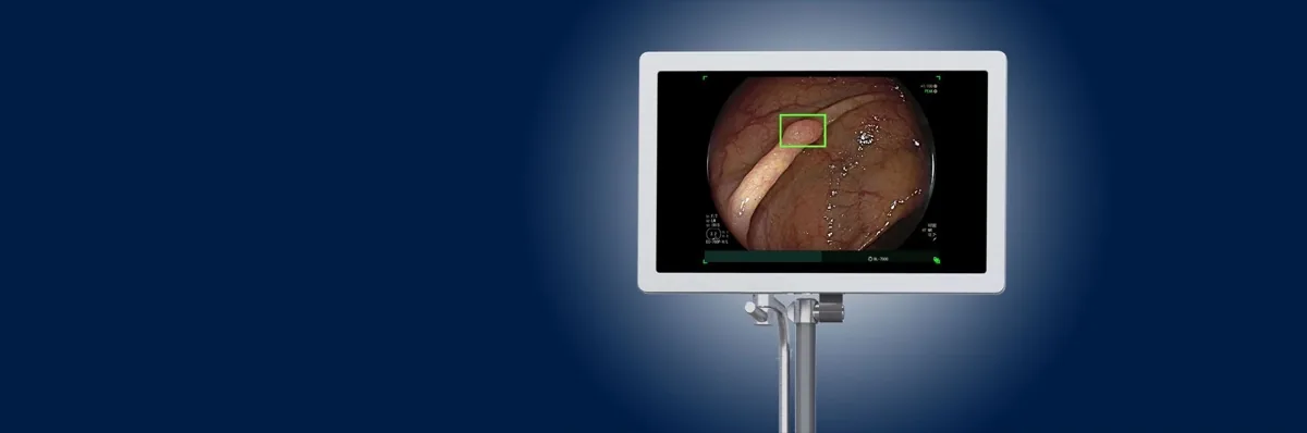 GI Genius™ Intelligent Endoscopy Module