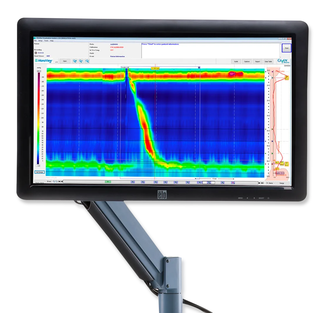 ManoScan™ ESO High Resolution Manometry System